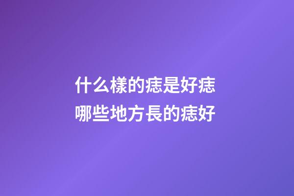 什么樣的痣是好痣 哪些地方長的痣好